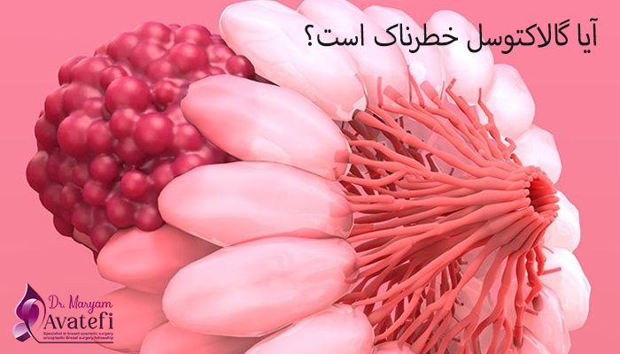آیا گالاکتوسل خطرناک است؟