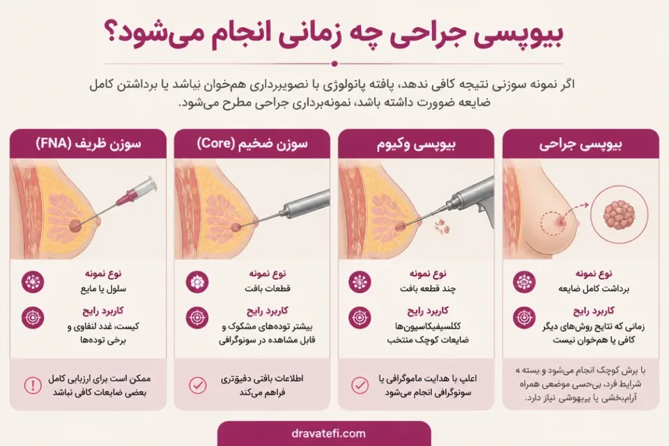 نمای توضیحی درباره بیوپسی جراحی چه زمانی انجام میشود